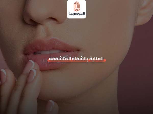 العناية بالشفاه المتشققة