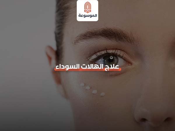 علاج الهالات السوداء